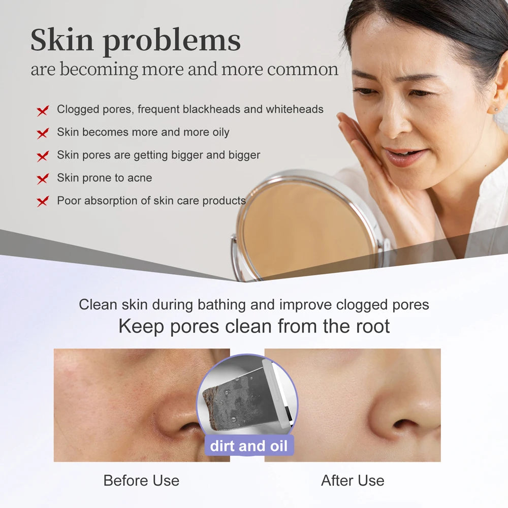 ANLAN Ultrasonic Skin Scrubber Peeling Facial Ultrasonic EMS Face Lifting LED Therapy Skin Care Pore Deep Cleansing Machine IPX7 - SmartBlip