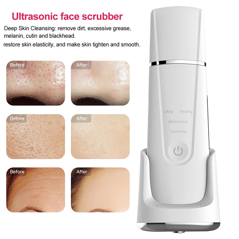 Ultrasonic Face Cleaner Skin Scrubber With Wireless Charging Base Ultrasound Vibration Massager Face Peeling Clean Tone Lift - SmartBlip