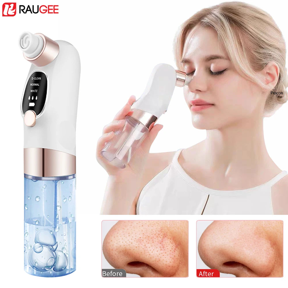 Woman using a skincare device with before and after results on a white background